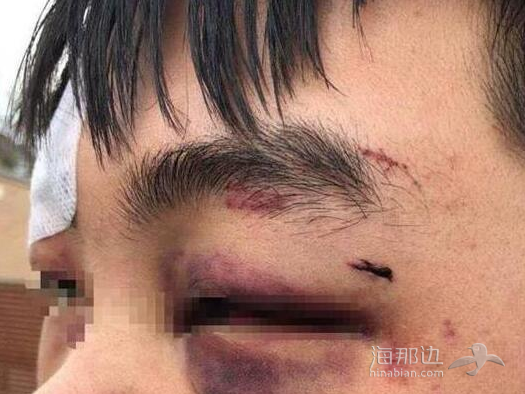 ccb6a1fd5fbcdfa458a7aaa6dd44df5a.png ..