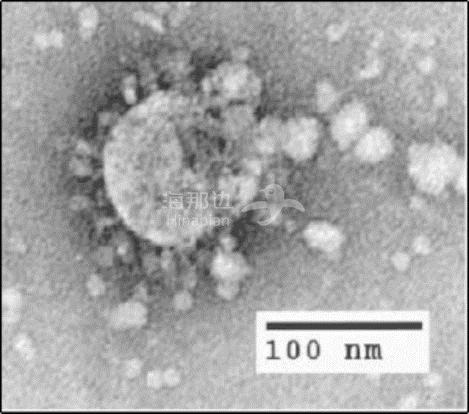 病毒颗粒5--SARS 病毒颗粒的电子显微镜摄影图.jpg