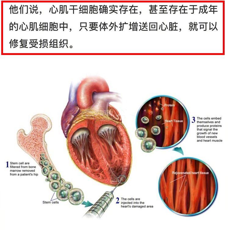 克隆心脏图片