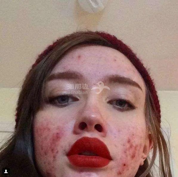 ..