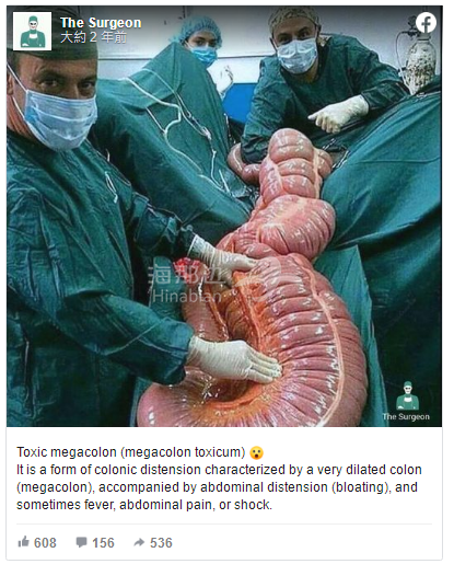 千年木乃伊竟是虫子折磨致死,生前吃蚱蜢憋屎…状况惨|海那边海外社区