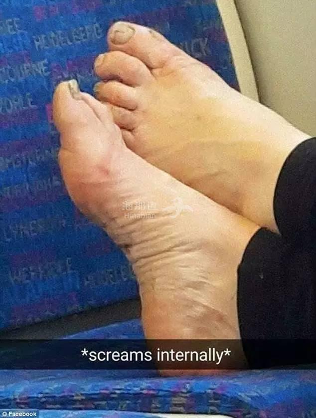 但是把赤脚放在火车座椅上,澳洲穿人字拖出门的情况很多,可能会造成